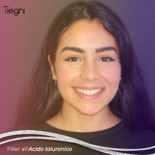 Filler Studio Tieghi