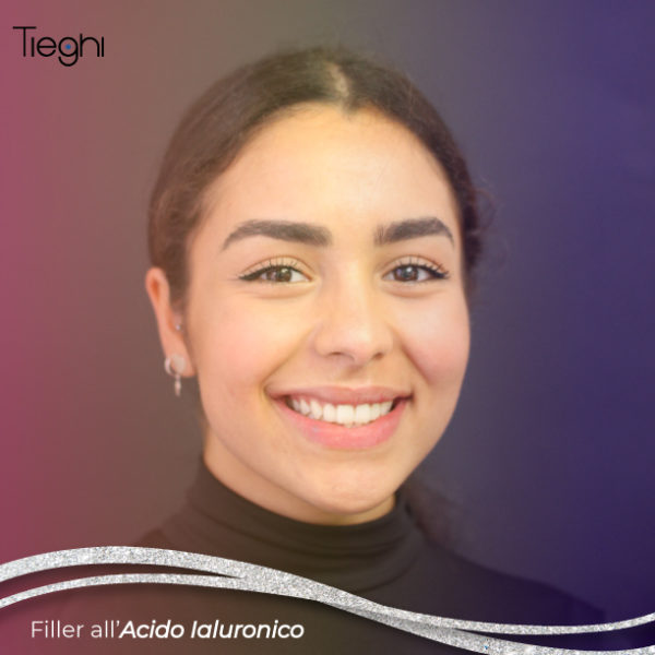 Filler Studio Tieghi