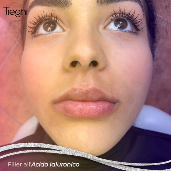 Filler Studio Tieghi