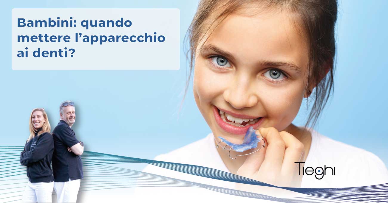 quando mettere apparecchio denti bambini